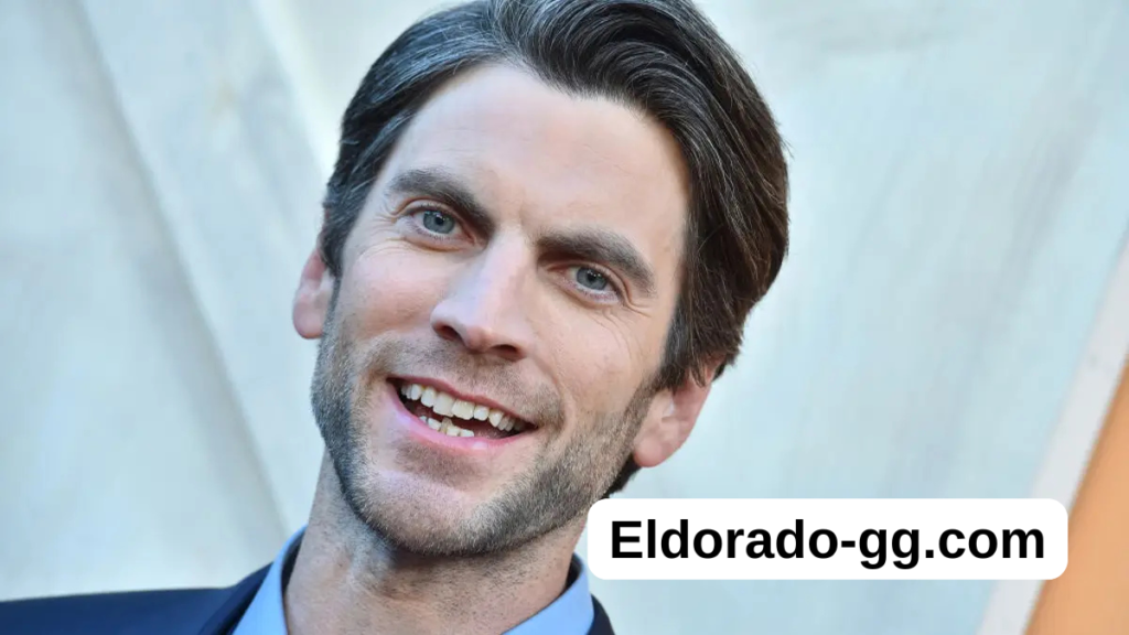 wes bentley teeth