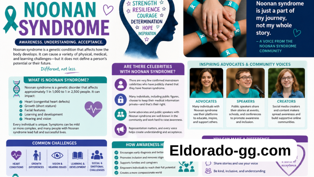 celebrities with noonan syndrome