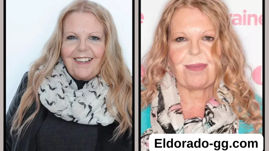 sally thomsett face illness