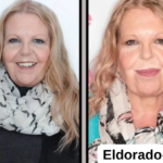 sally thomsett face illness
