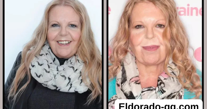 sally thomsett face illness